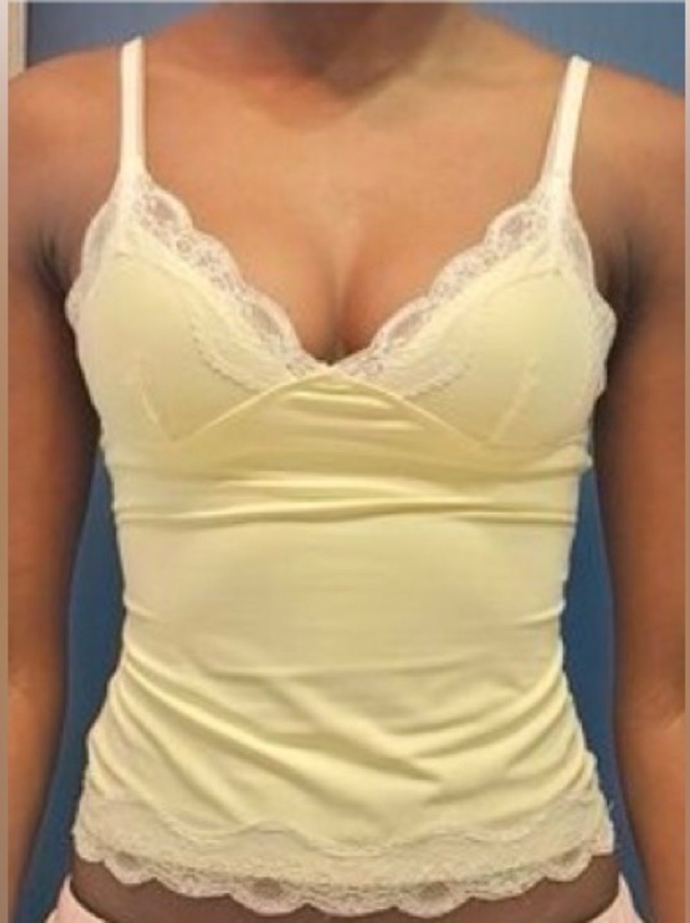 Lioness butter Yellow Lace Trim Cami Top